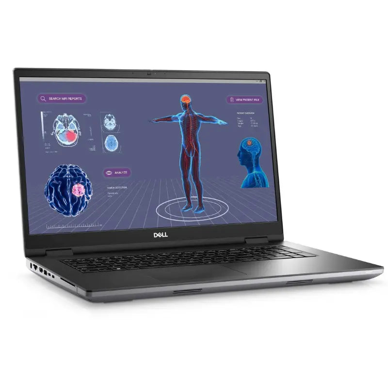 Dell Précision 7730 – Workstation i7 / 24 Go / Radeon WX7100 RecondistorePC